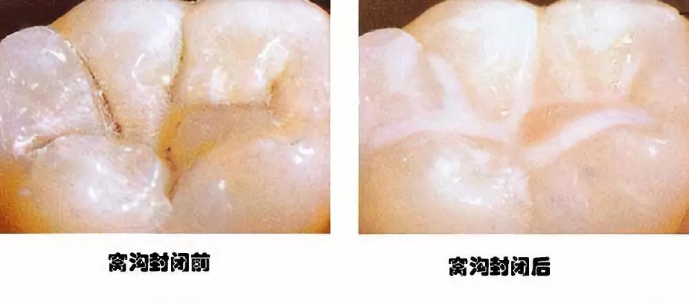 【小牙医,大童趣】 做小牙医,乐探奇妙口腔世界 博诚口腔(图20)